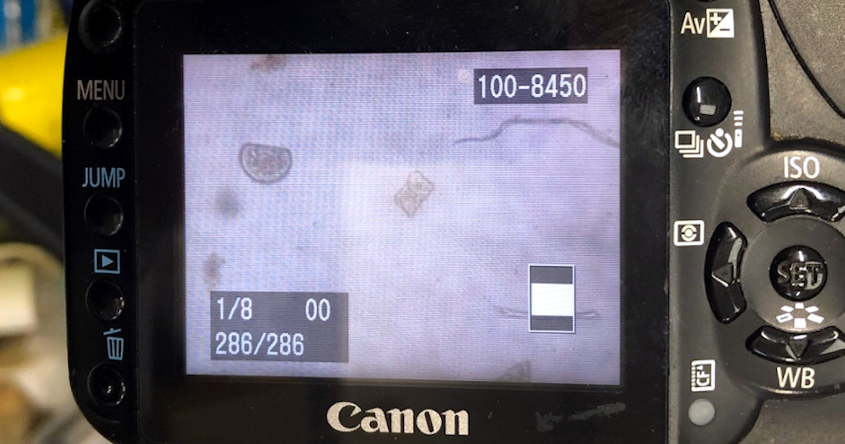 Blue Mussel larvae (D larvae) at Cartron Point Shellfish. Photo by Colin Hannon.